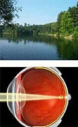 зрение без катаракты